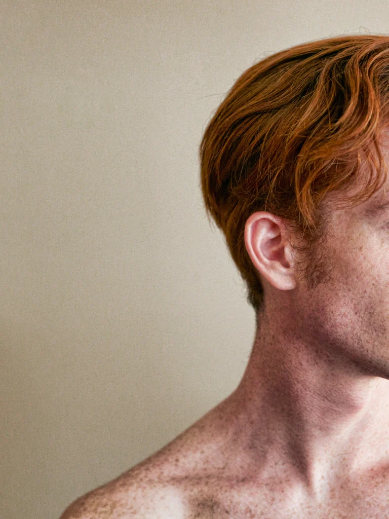 skin on man with red hair